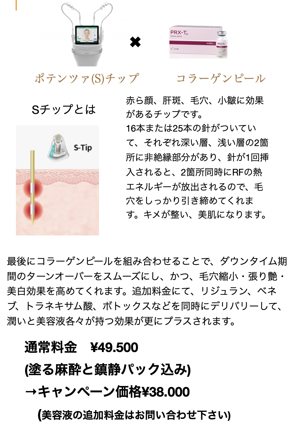 10月のキャンペーン(ポテピール)